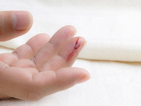 Mơ thấy chảy máu tay đánh con gì? Chảy máu tay trong mơ là điềm gì? 1 Chảy máu tay có điềm báo gì?